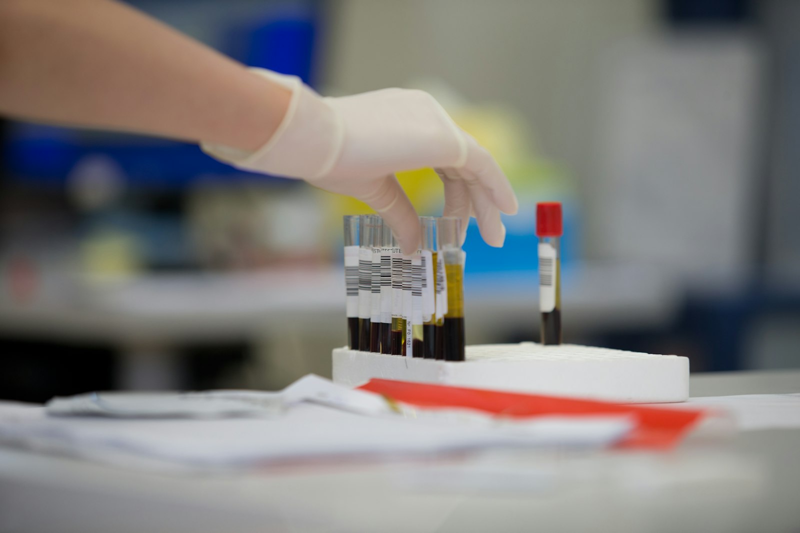 Foto illustrativa: provette per le analisi in laboratorio