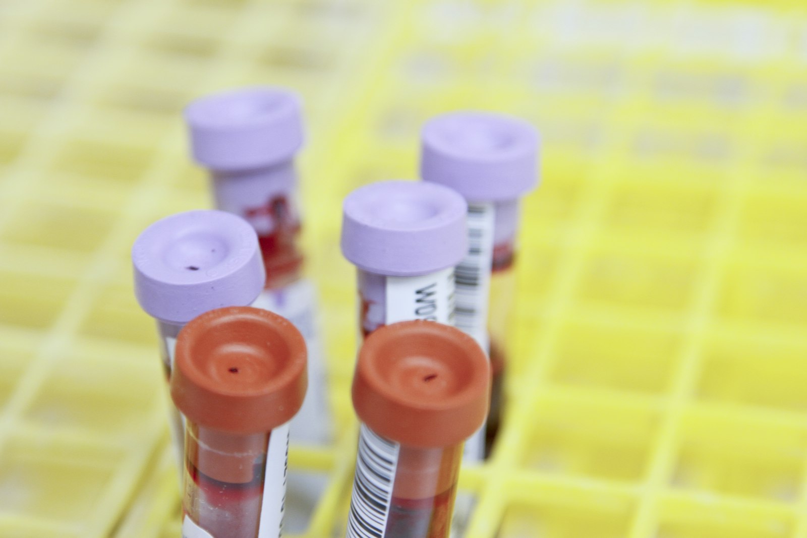 Provette per le analisi del sangue in un rack